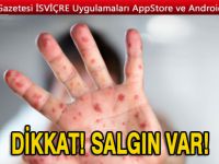 Dikkat! Avrupa’da kızamık salgını: 37 kişi hayatını kaybetti